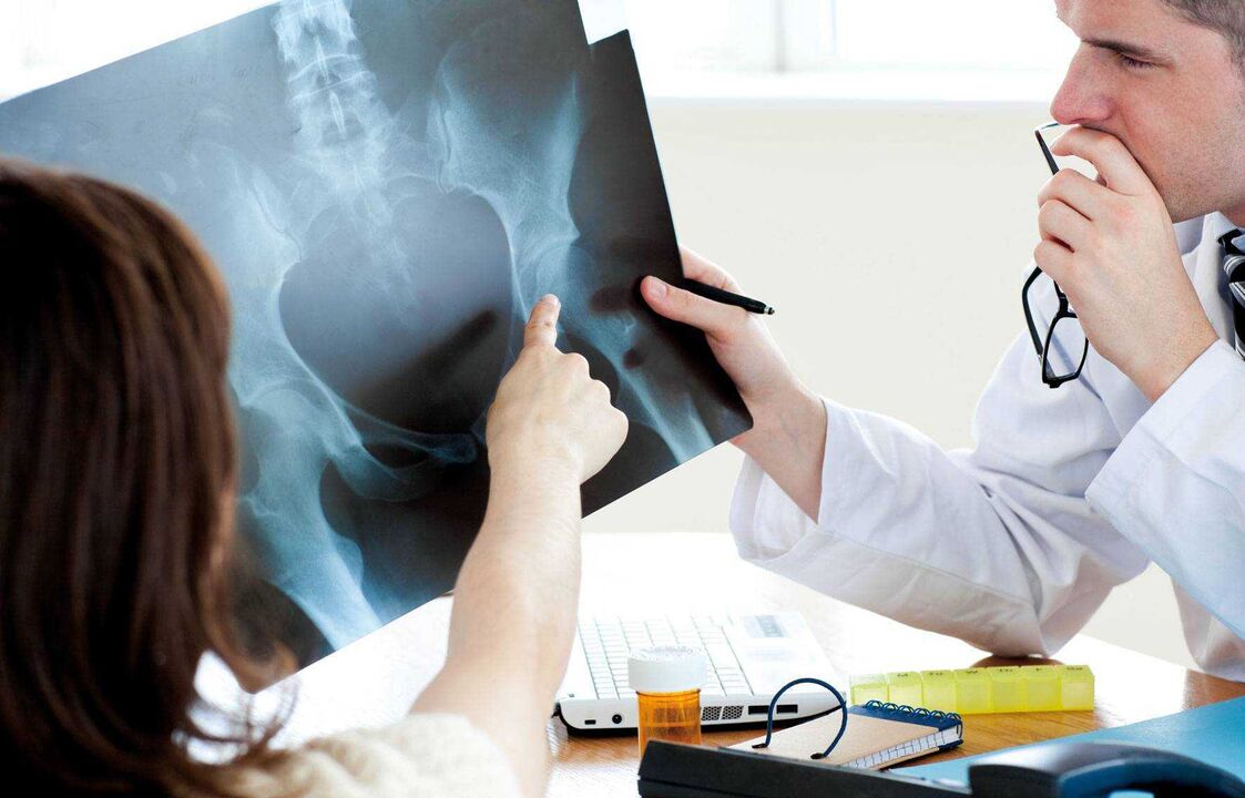 Ärzte, die Röntgenbilder auf Hüftarthrose untersuchen
