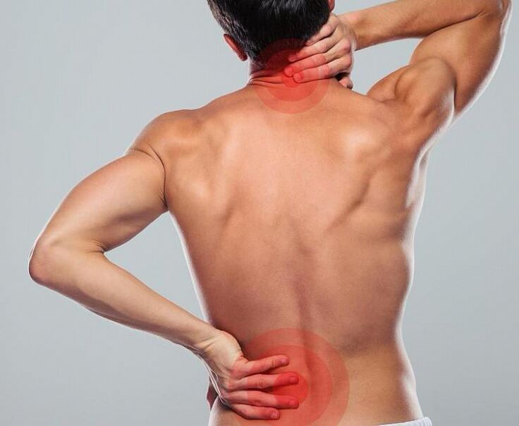 Ein Mann hat eine Osteochondose für die Wirbelsäule